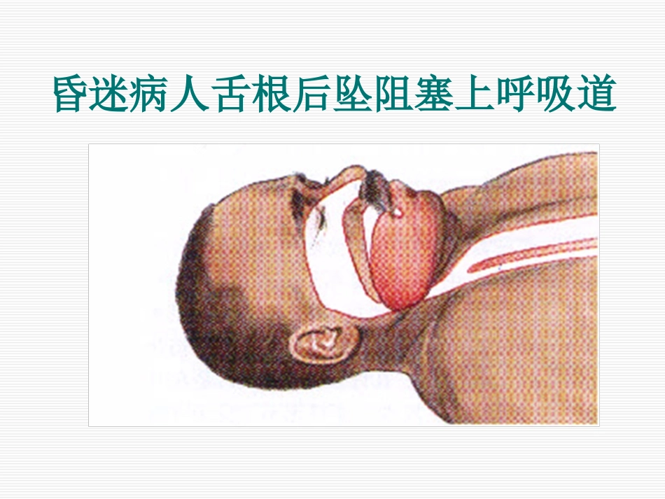 安全健康讲座(修订)_第14页