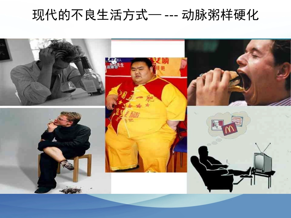 颈动脉狭窄的治疗科普讲座_第3页