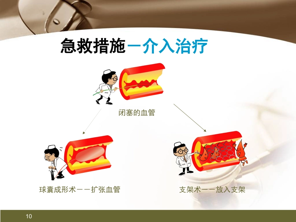 心肌梗死健康宣教PPT课件_第10页