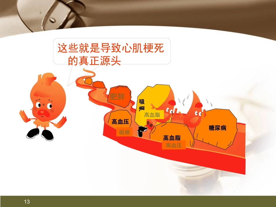 心肌梗死健康宣教PPT课件_第13页