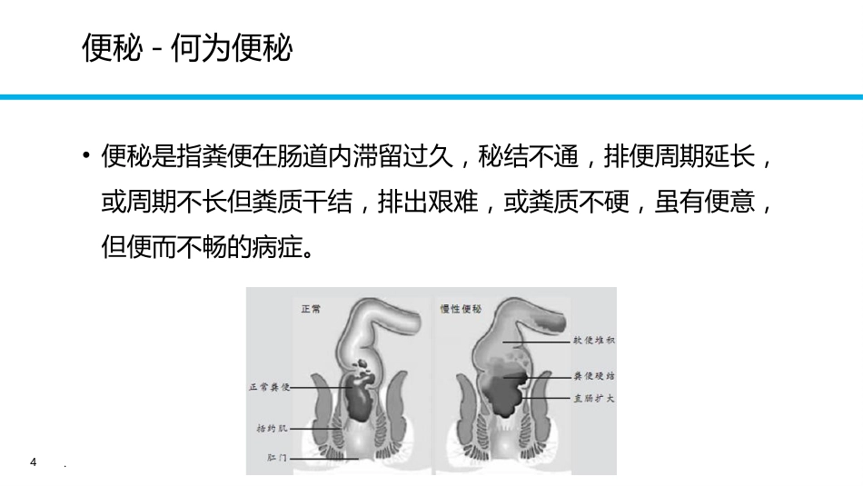 便秘健康教育PPT课件_第4页