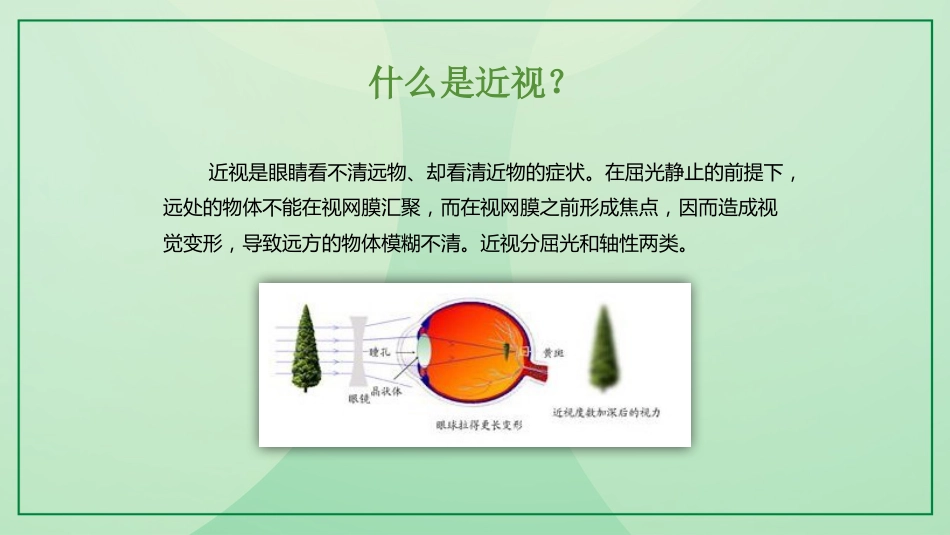 保护视力预防近视_第11页