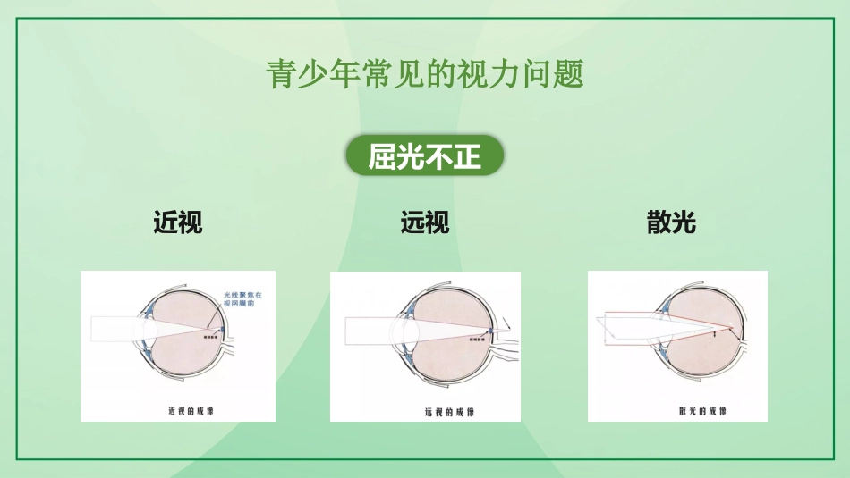 保护视力预防近视_第9页
