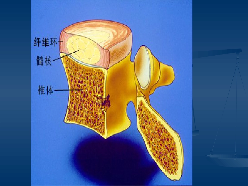腰腿痛的认识与防治(健康讲座)_第9页