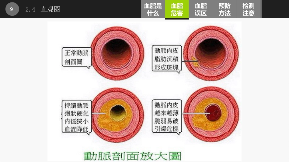 血脂讲座PPT课件_第9页