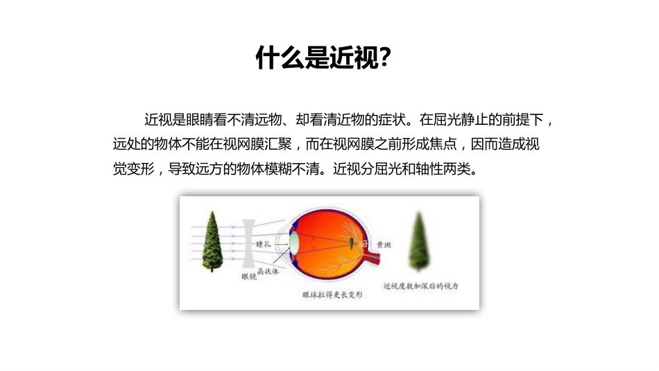 保护眼睛预防近视PPT(1)_第12页