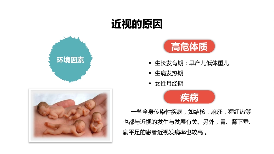 保护眼睛预防近视PPT(1)_第14页