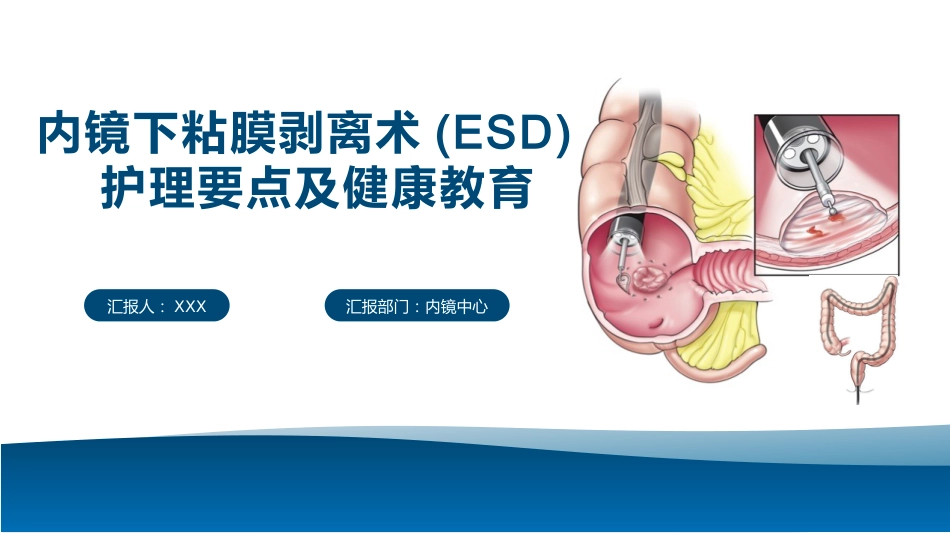 内镜下粘膜剥离术(ESD)护理要点及健康教育_第1页