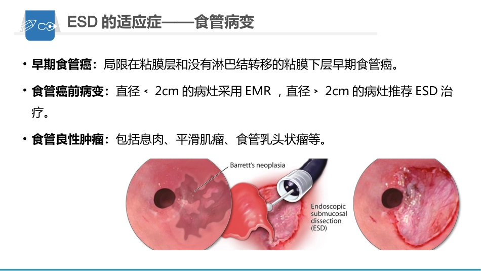 内镜下粘膜剥离术(ESD)护理要点及健康教育_第10页