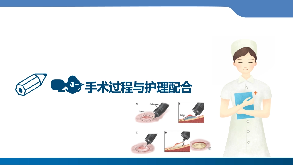 内镜下粘膜剥离术(ESD)护理要点及健康教育_第12页