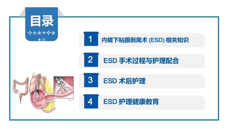 内镜下粘膜剥离术(ESD)护理要点及健康教育_第2页