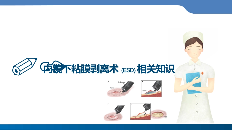 内镜下粘膜剥离术(ESD)护理要点及健康教育_第3页
