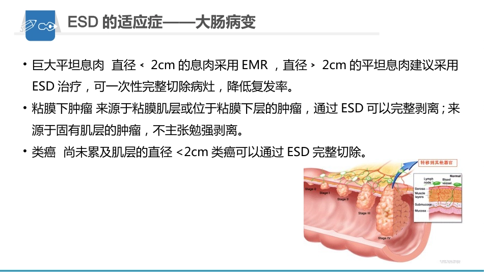 内镜下粘膜剥离术(ESD)护理要点及健康教育_第9页