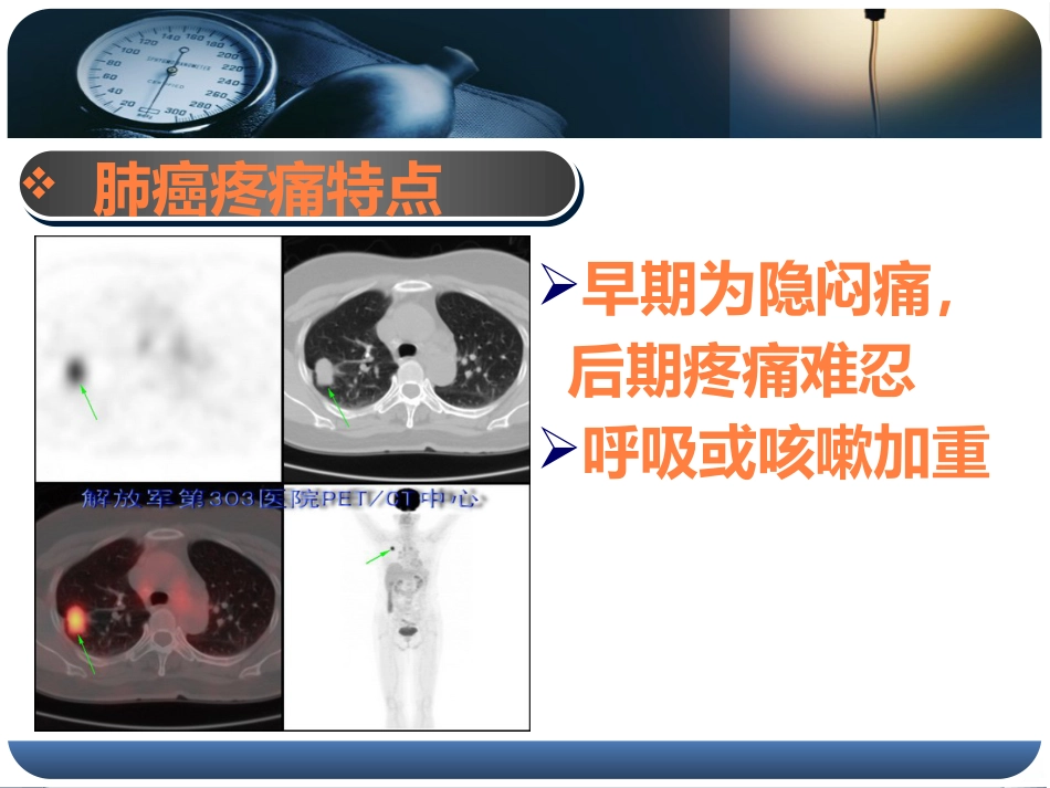 健康讲座胸痛PPT课件_第10页