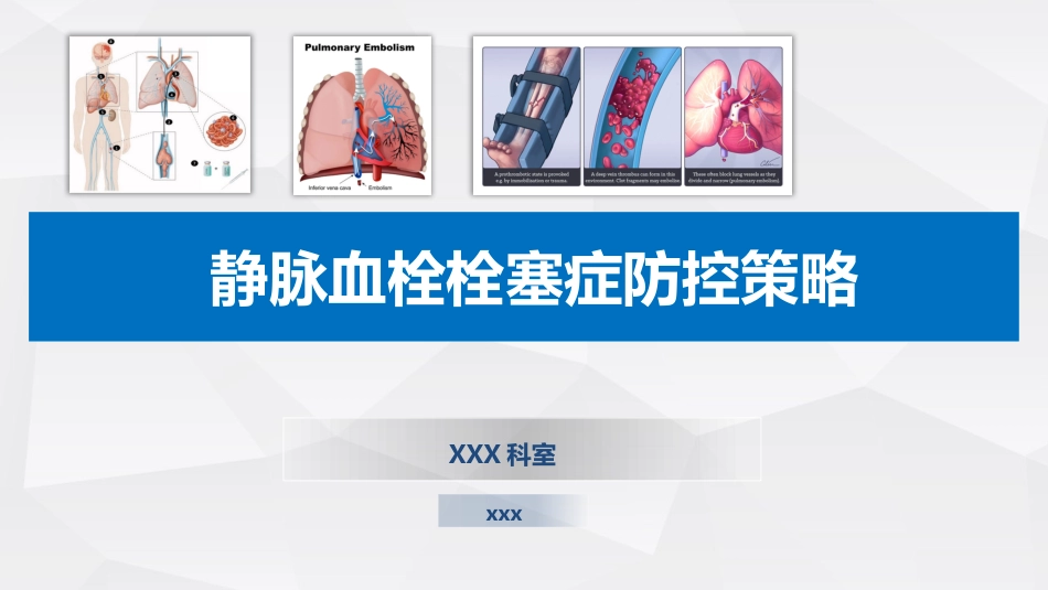 患者静脉血栓栓塞症防控策略_第1页