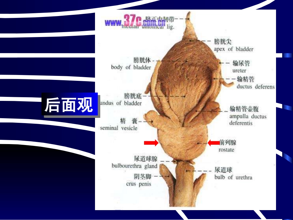良性前列腺增生病_第3页