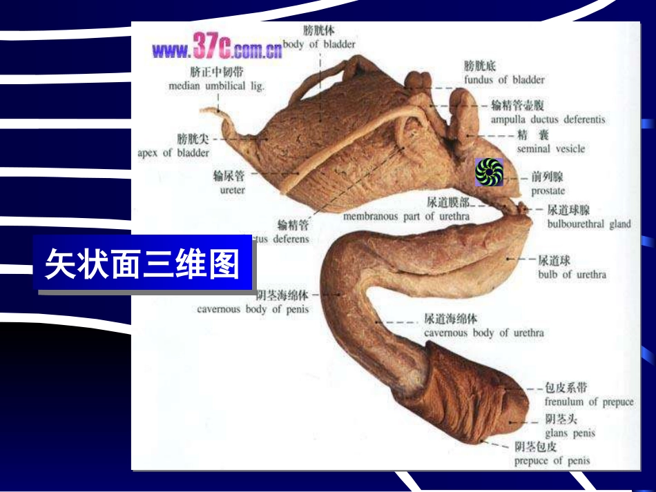 良性前列腺增生病_第4页
