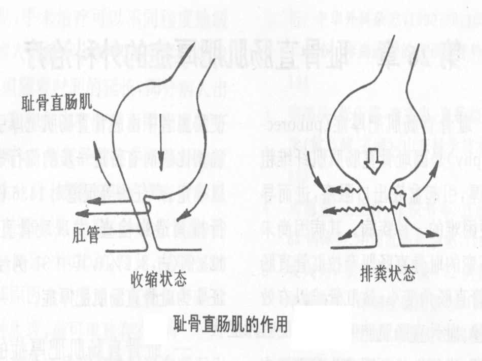便秘健康讲座_第3页