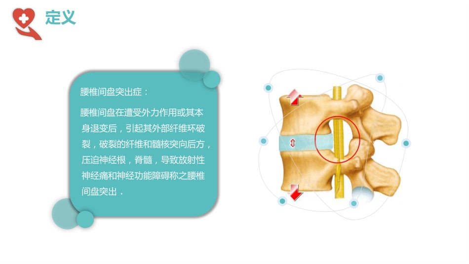 【医护指南】健康宣讲：腰椎间盘突出症健康教育2_第3页
