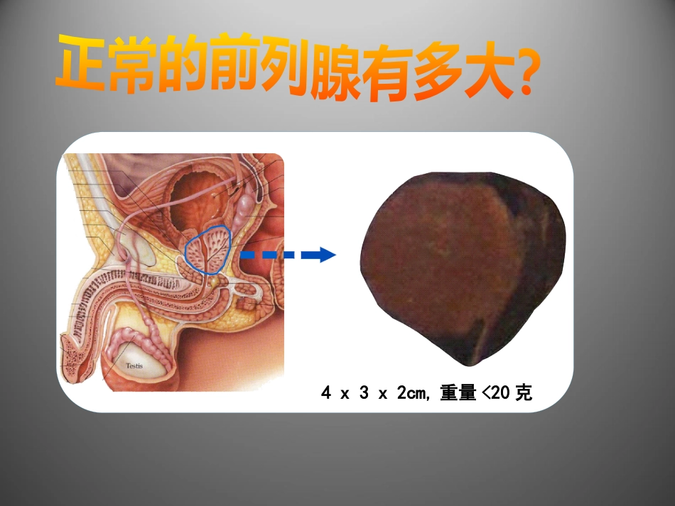 前列腺疾病讲座_第14页