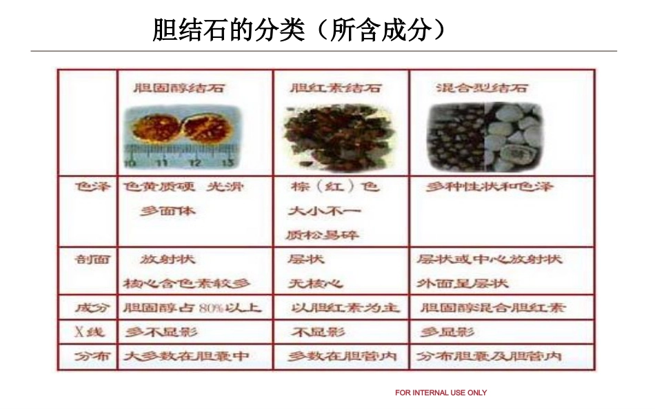 胆结石和泌尿系结石健康教育_第6页