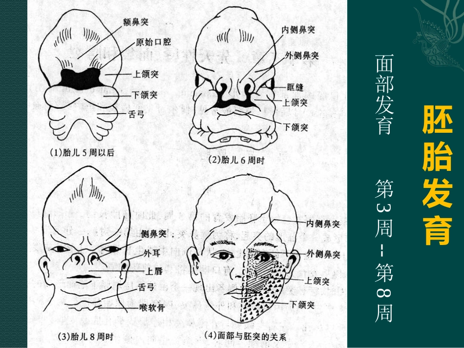 唇裂讲座_第5页