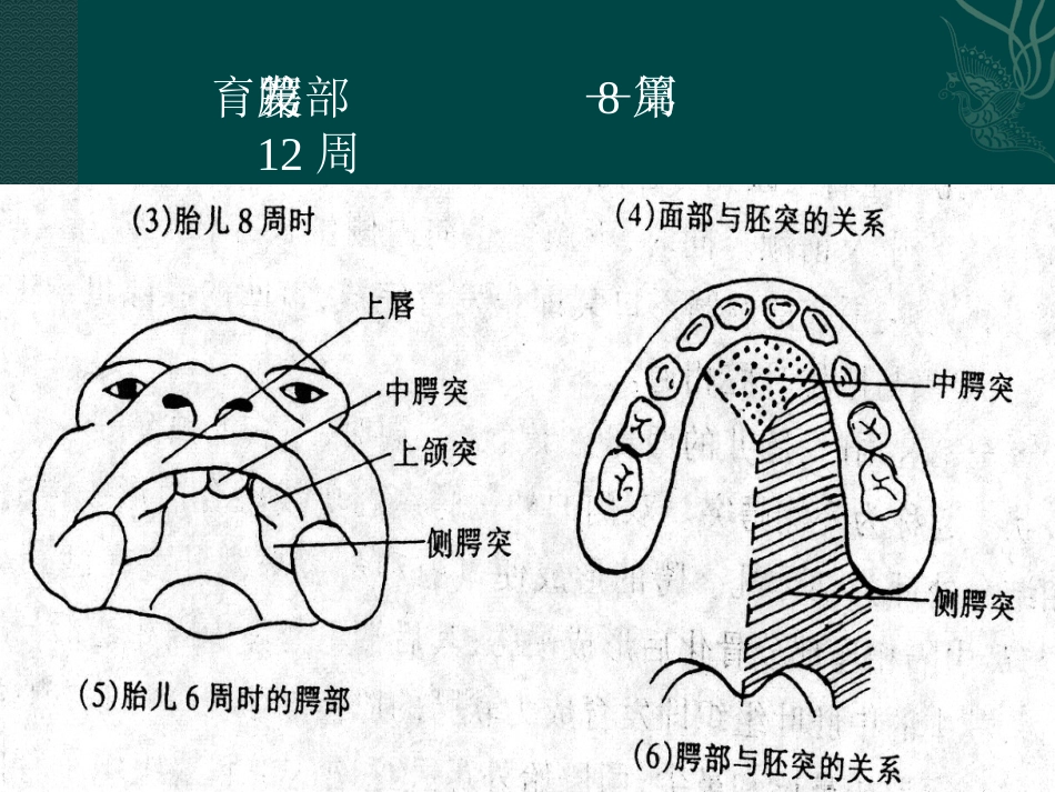 唇裂讲座_第6页