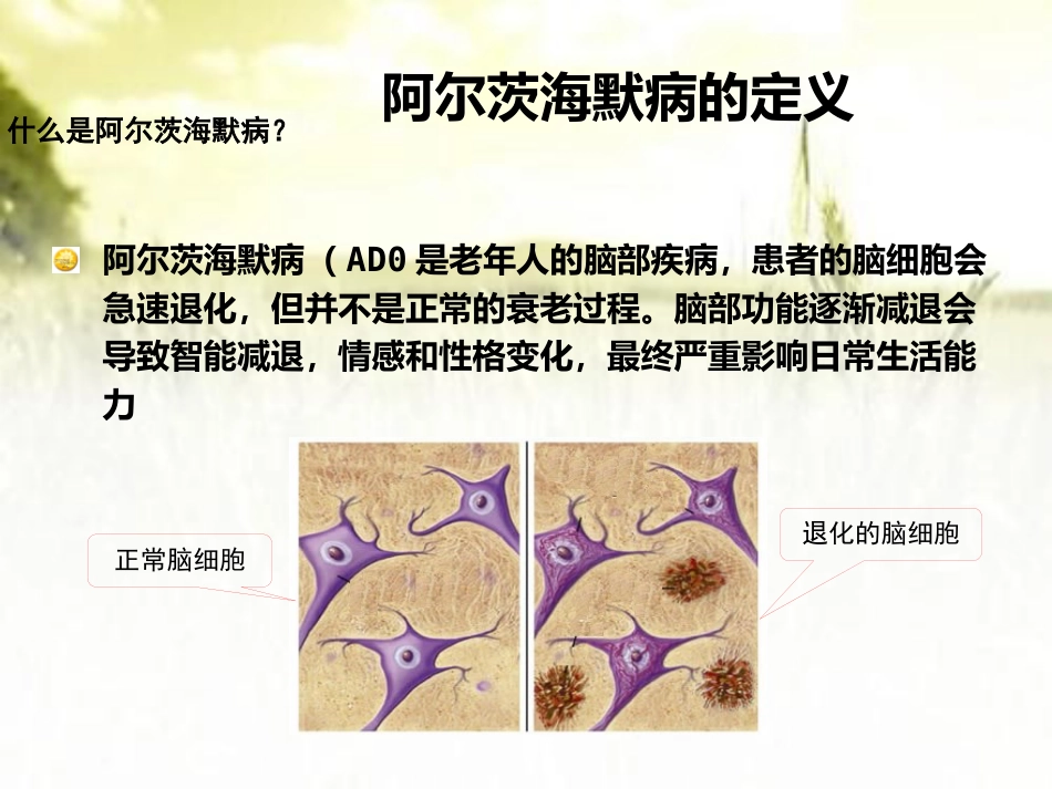 阿尔茨海默病健康讲座ppt_第9页