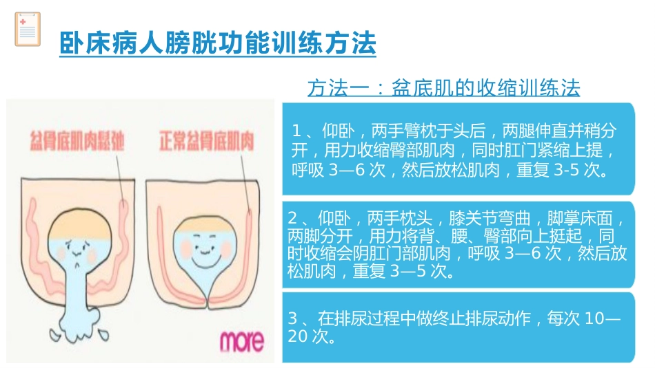 卧床病人膀胱功能训练健康宣教_第12页