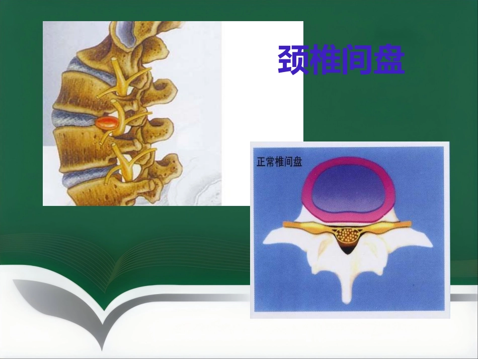 颈椎腰椎病科普讲座_第13页