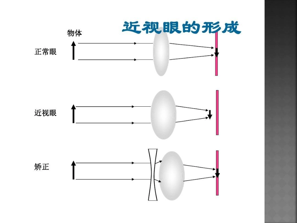 爱眼护眼预防近视27页PPT_第11页