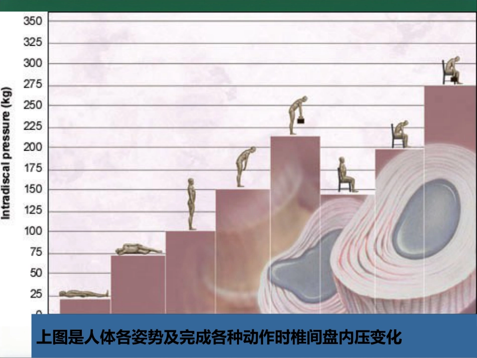 腰腿痛健康讲座_第10页