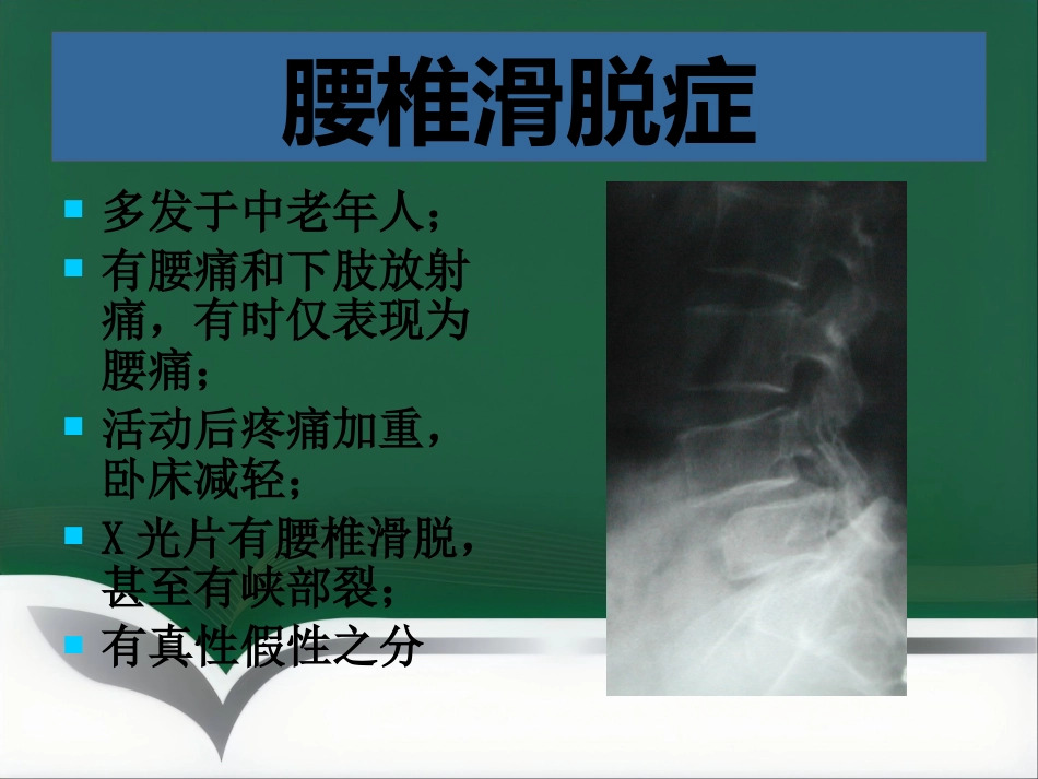 腰腿痛健康讲座_第15页