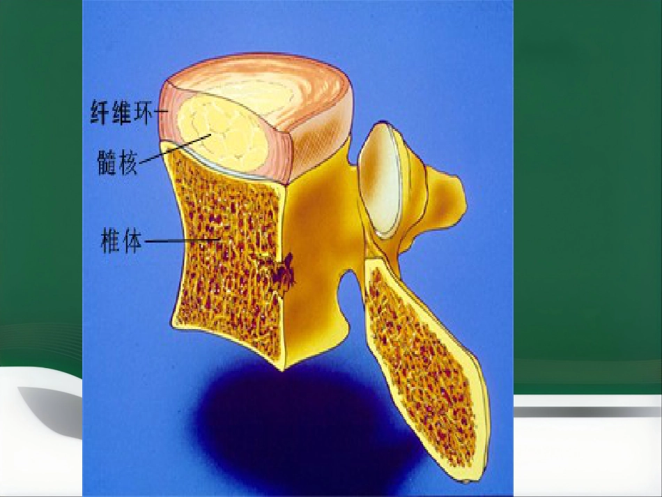 腰腿痛健康讲座_第7页