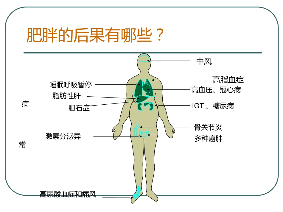 《脂肪肝de健康教育》PPT课件_第9页