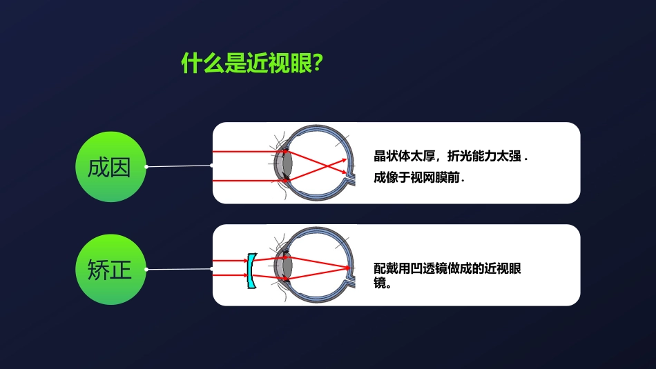 保护视力预防近视主题教育PPT模板_第7页