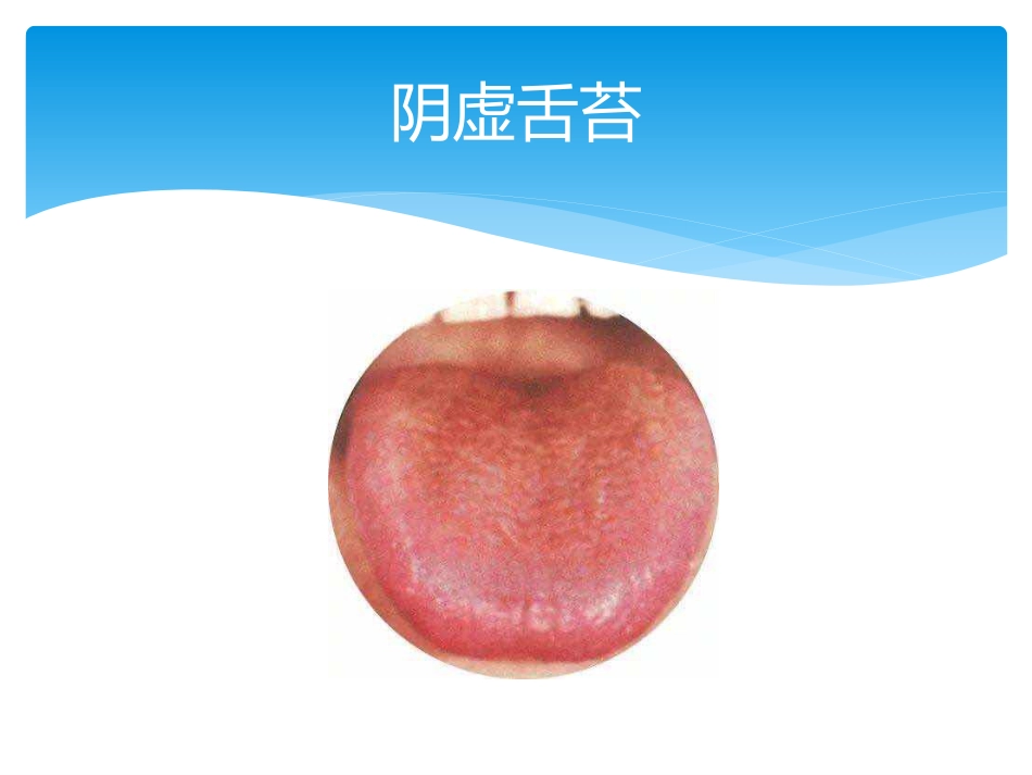舌诊讲座_第12页