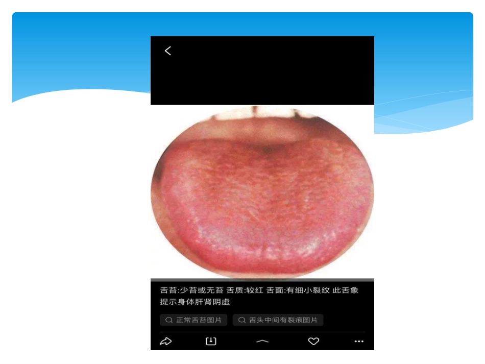 舌诊讲座_第14页
