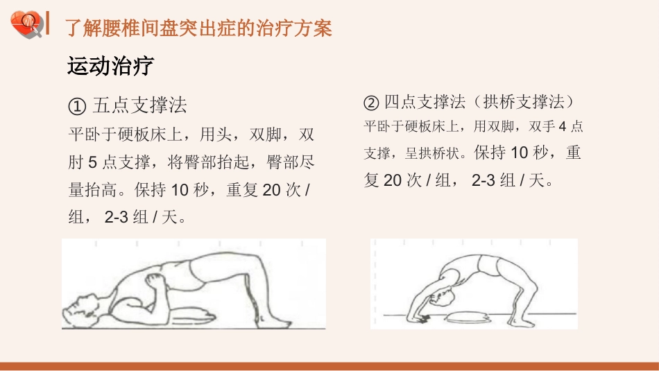 【医护指南】健康宣讲：腰椎间盘突出症健康教育1_第13页