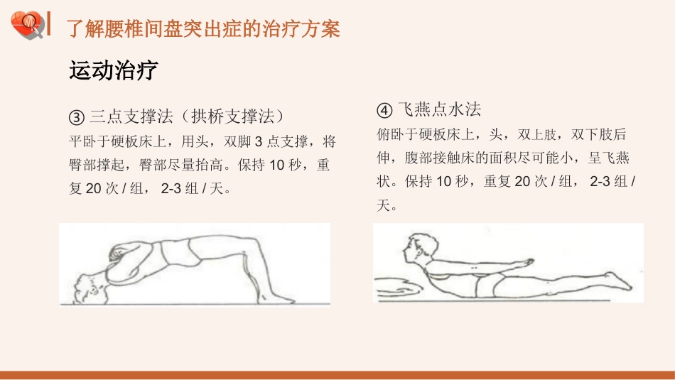 【医护指南】健康宣讲：腰椎间盘突出症健康教育1_第14页