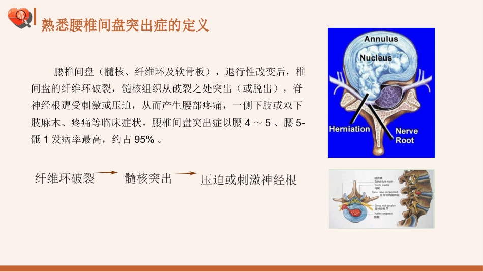 【医护指南】健康宣讲：腰椎间盘突出症健康教育1_第3页
