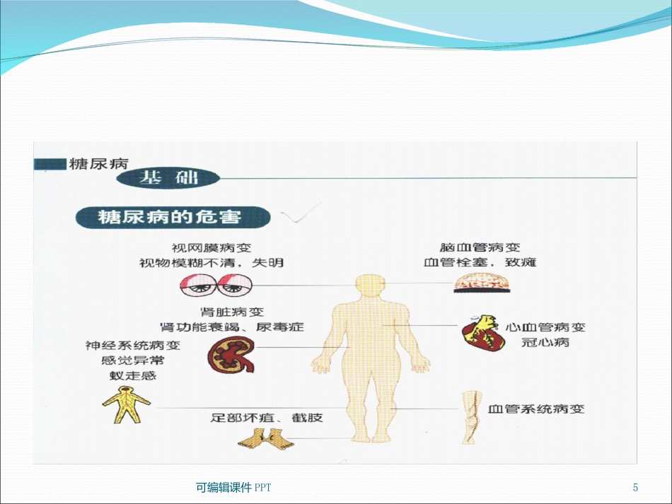 糖尿病健康知识宣教ppt课件_第5页