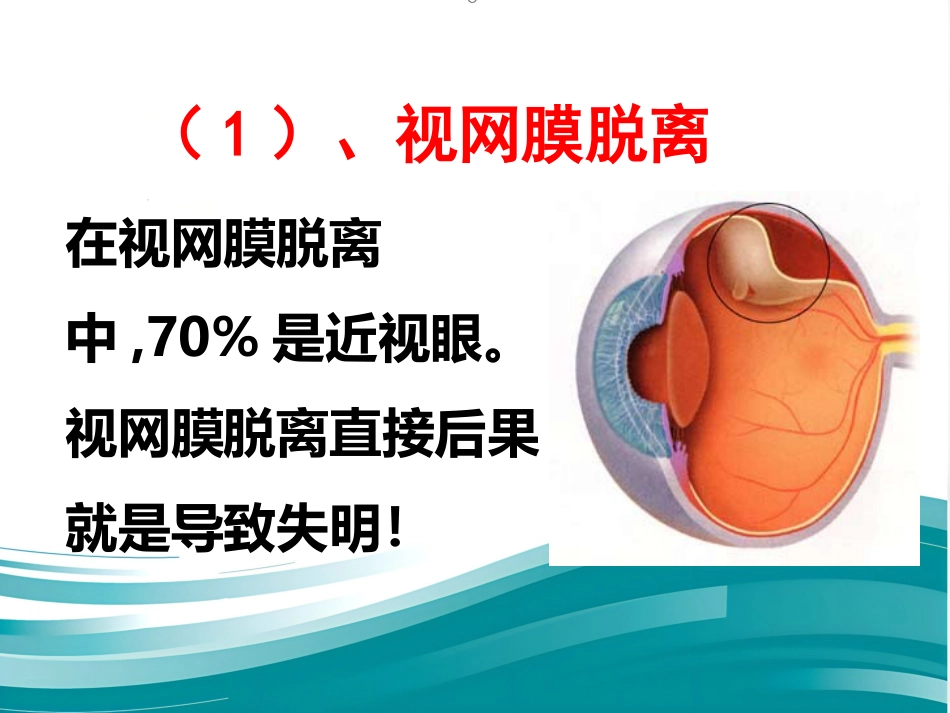 爱眼护眼科普讲座PPT幻灯片_第5页