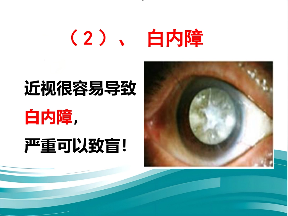 爱眼护眼科普讲座PPT幻灯片_第6页