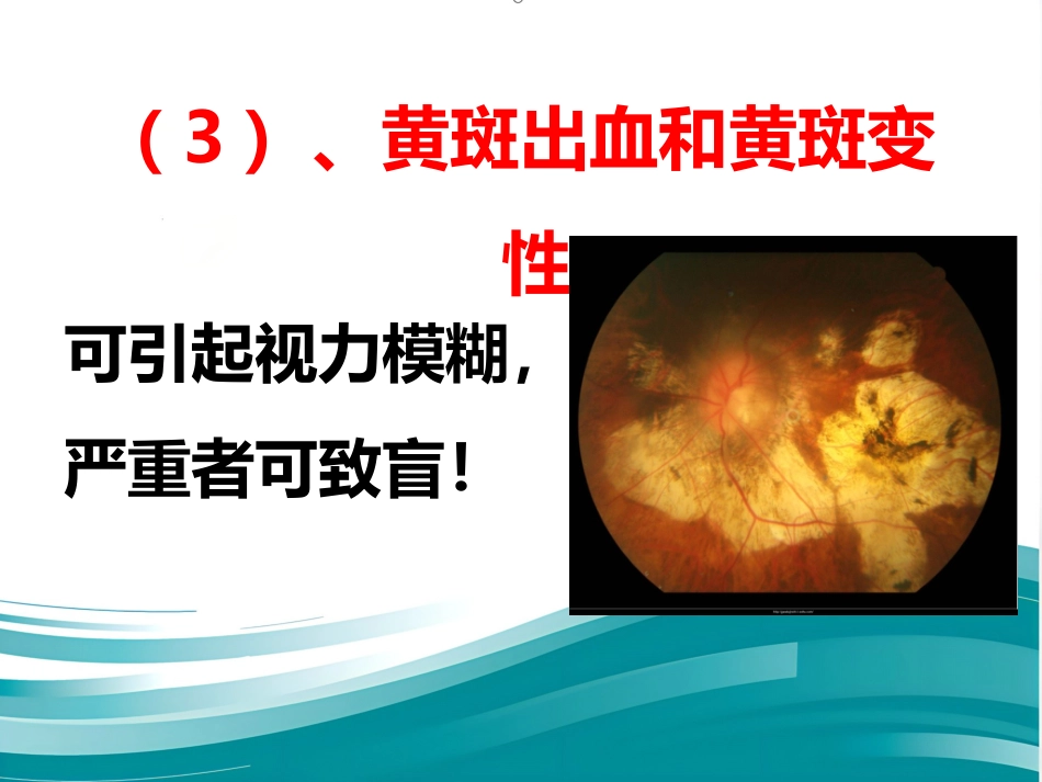 爱眼护眼科普讲座PPT幻灯片_第7页