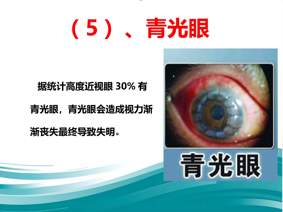 爱眼护眼科普讲座PPT幻灯片_第9页