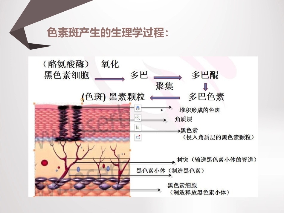 祛斑讲座课件_第4页