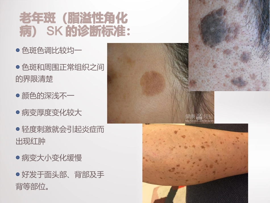 祛斑讲座课件_第7页