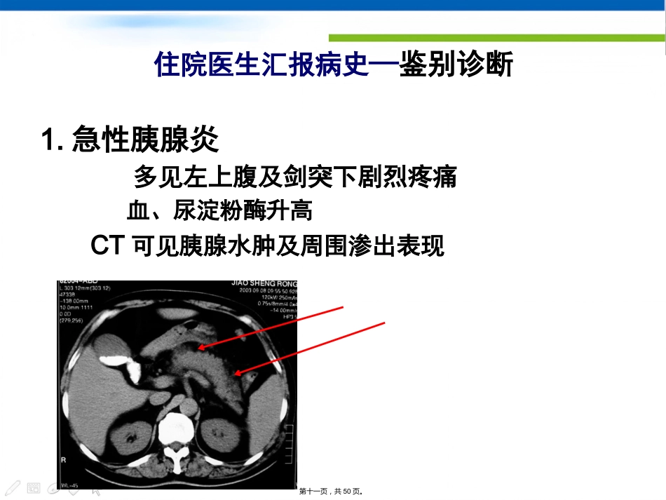 肝胆外科住院医生讲座(胆石症)_第11页