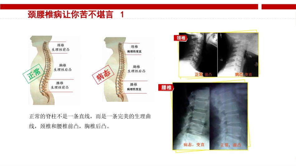 颈腰椎病健康讲座_第10页